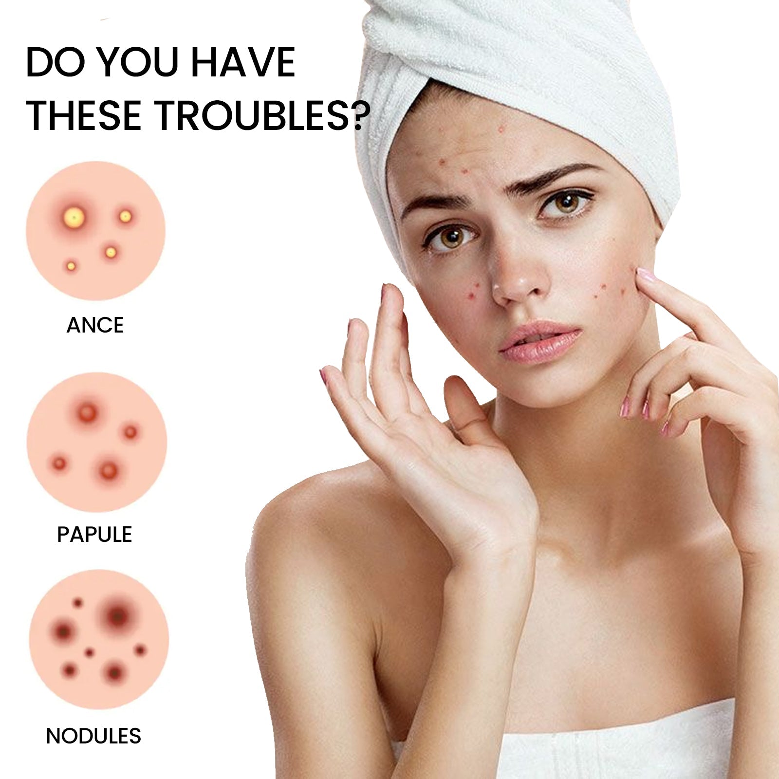 Acne Patch, Repair Facial Acne Invisible Concealer Hydrocolloid Patch