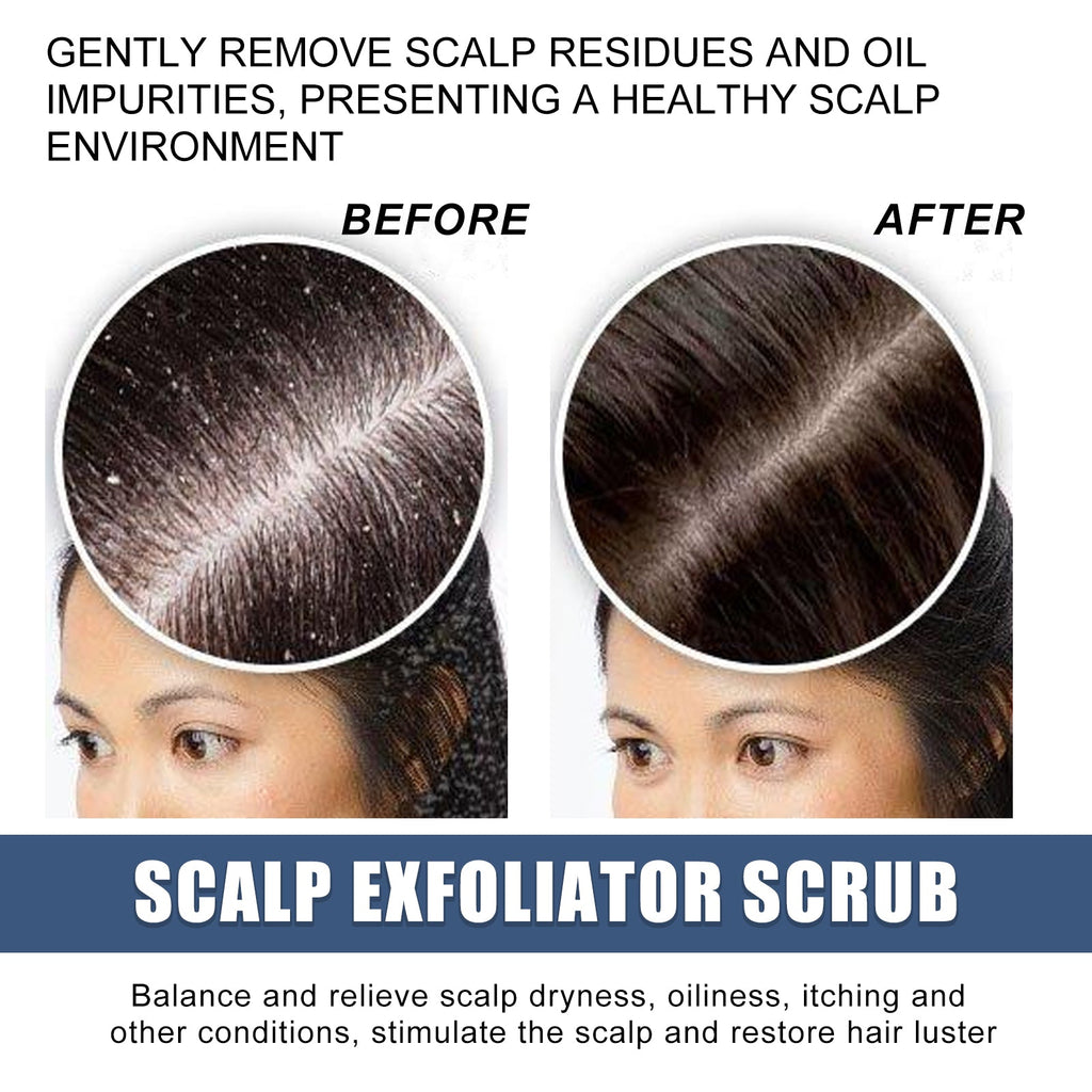 Scalp Exfoliating Scrub Moisturizes Dry Hair And Scalp Cleansing Treatment Refreshing Scrub