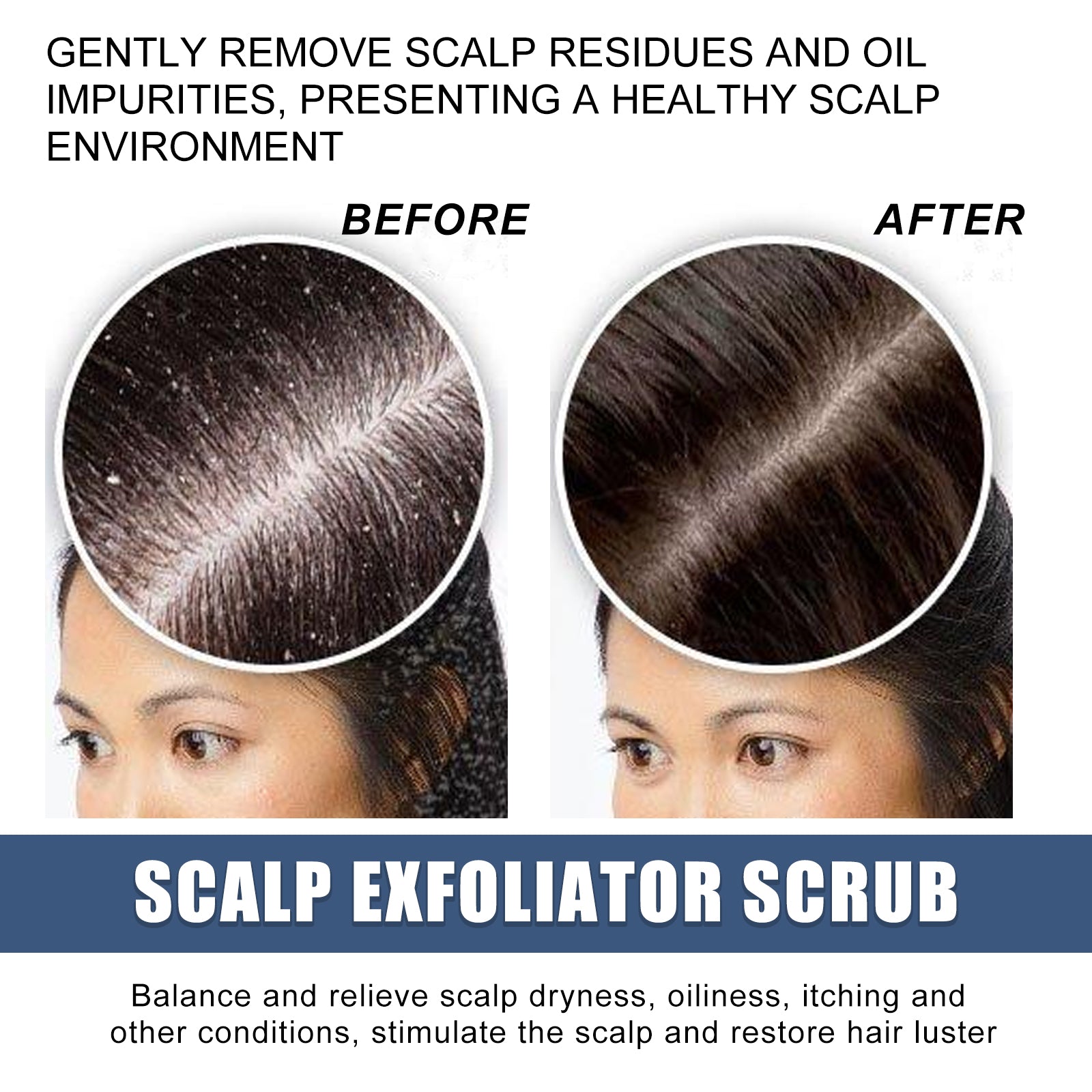 Scalp Exfoliating Scrub Moisturizes Dry Hair And Scalp Cleansing Treatment Refreshing Scrub
