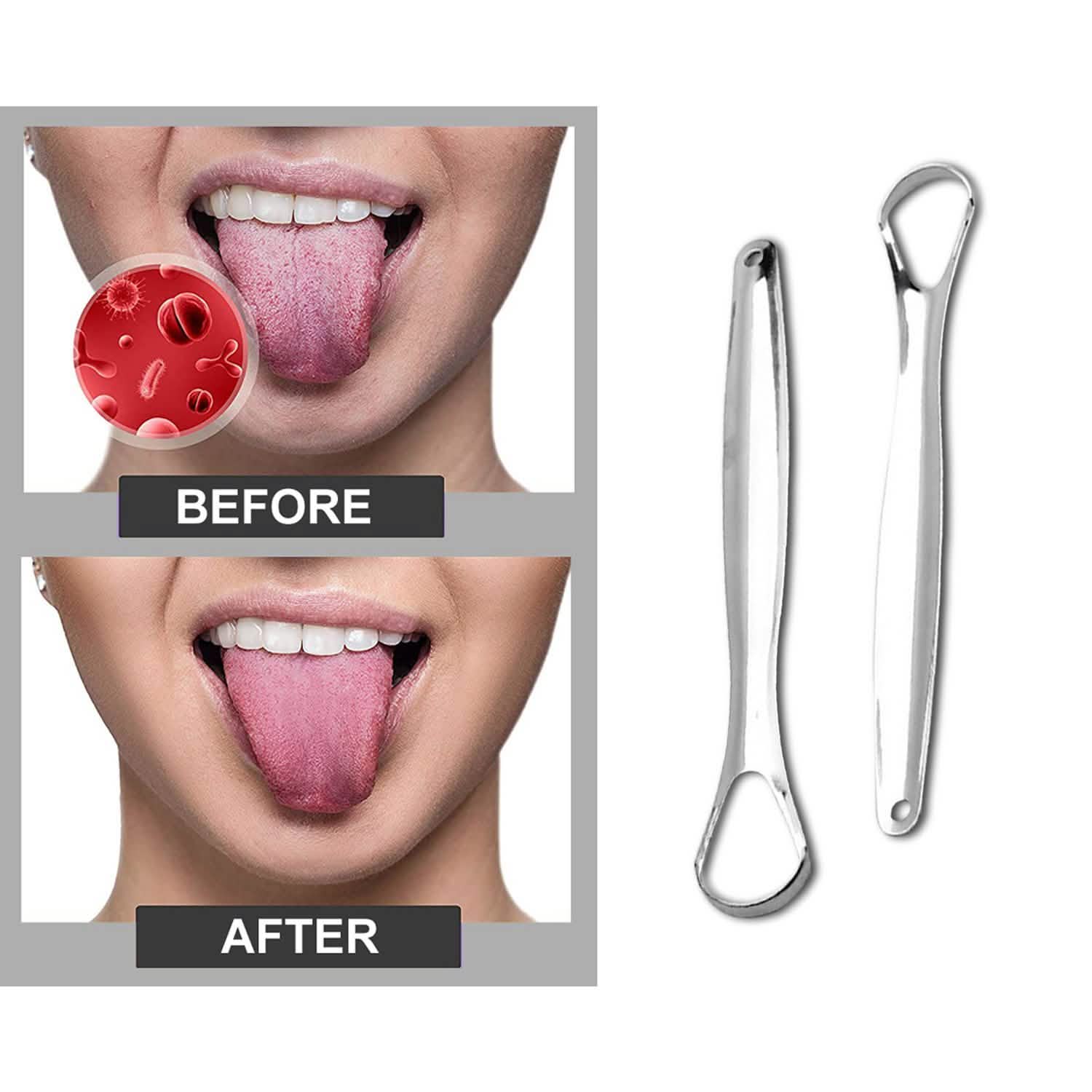 2-Pack: Stainless Steel Tongue Cleaner Scraper