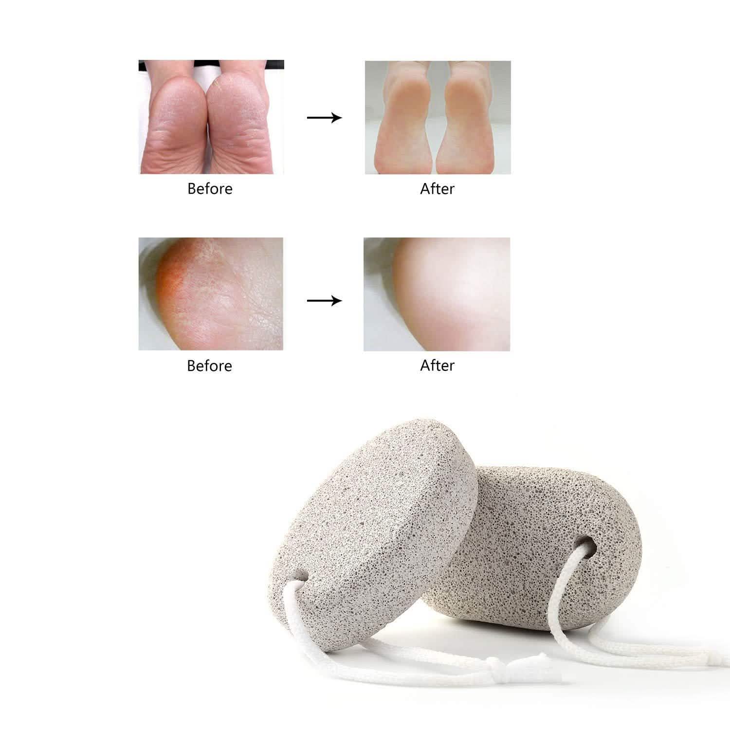 2-Pieces: Natural Pumice Stone