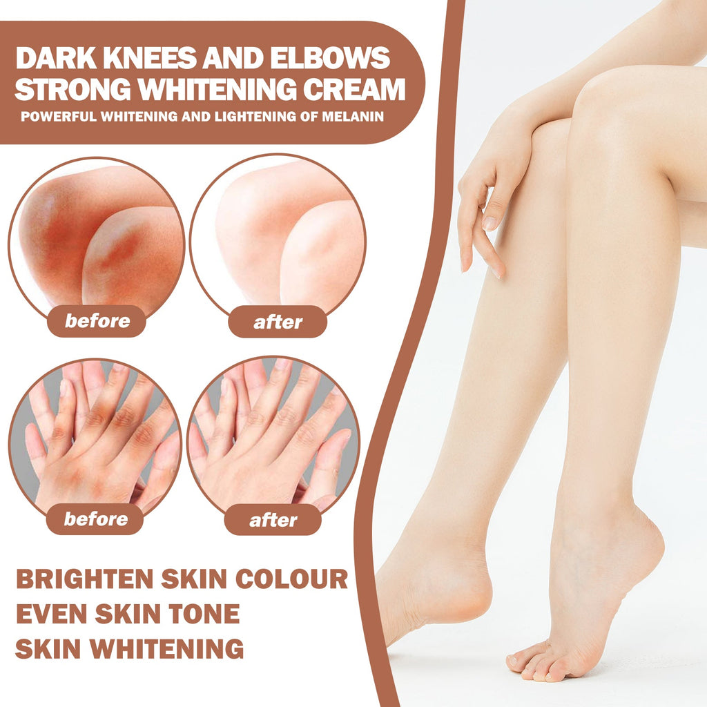 Joint Whitening Cream, Moisturizes Dull Skin Whitening Repair Cream For Joints And Elbows