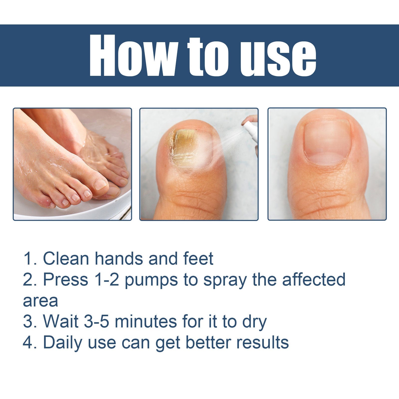 Nail Care Spray Gently Cleans Foot Nails Moisturizing And Brightening Nail Care Spray