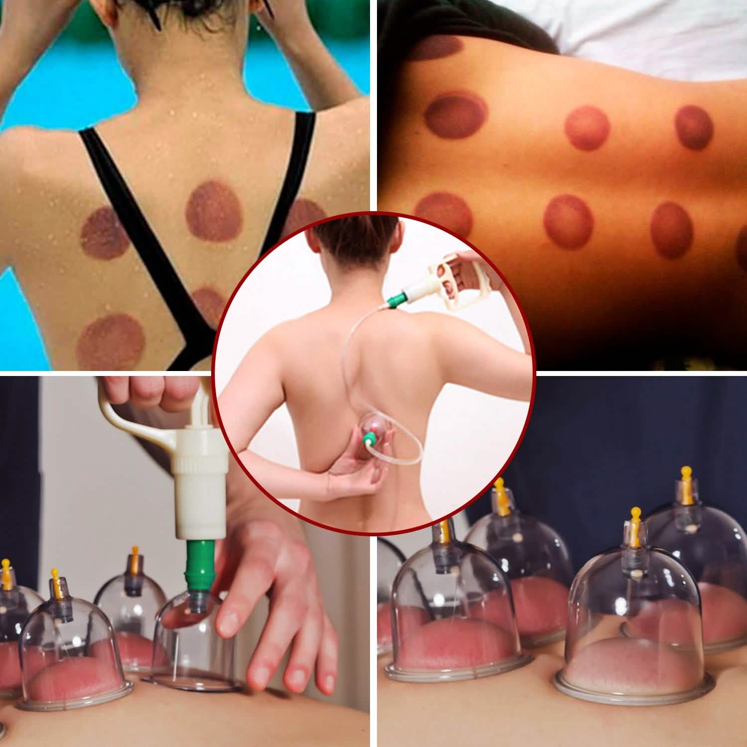 32 Cups Chinese Therapy Set