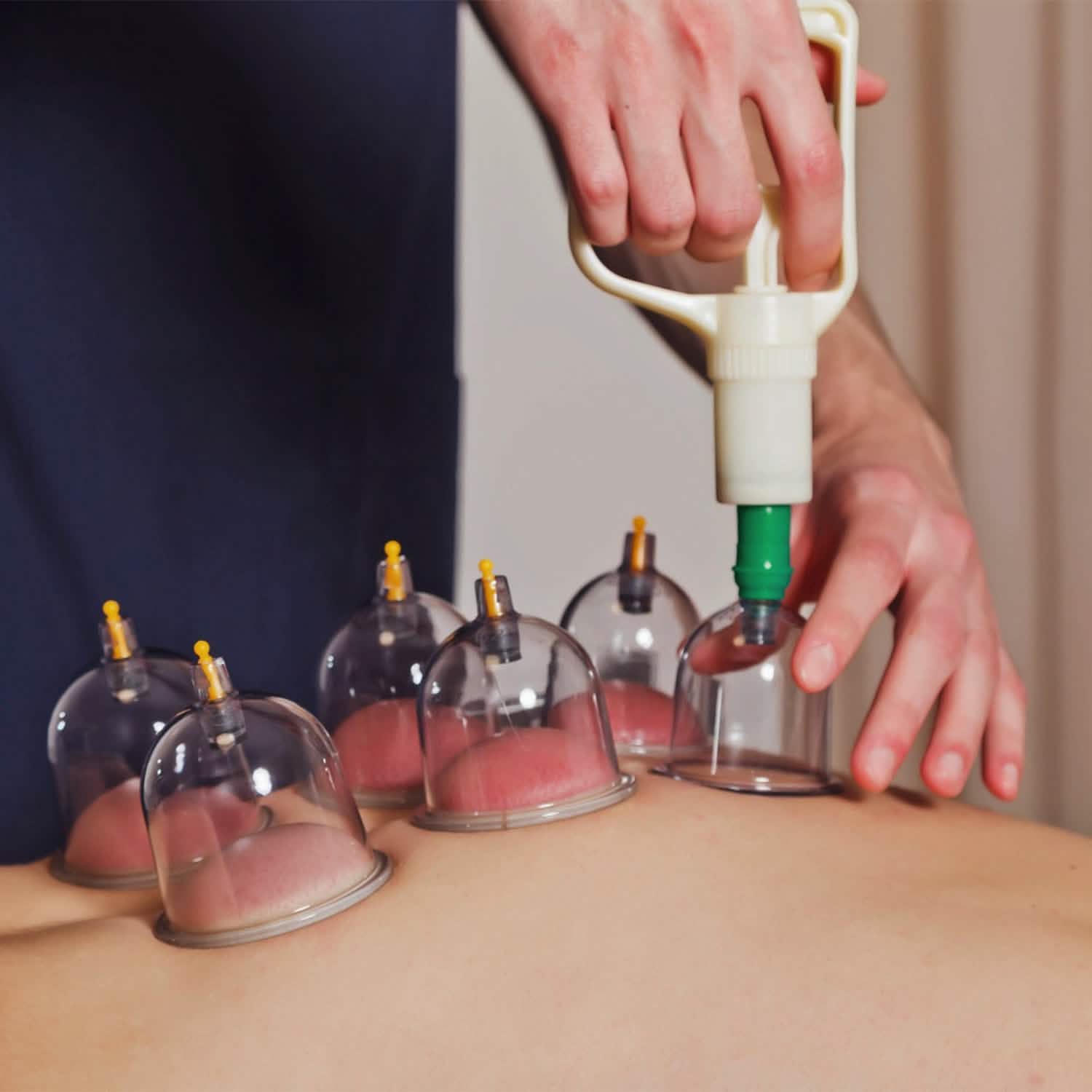 32 Cups Chinese Therapy Set