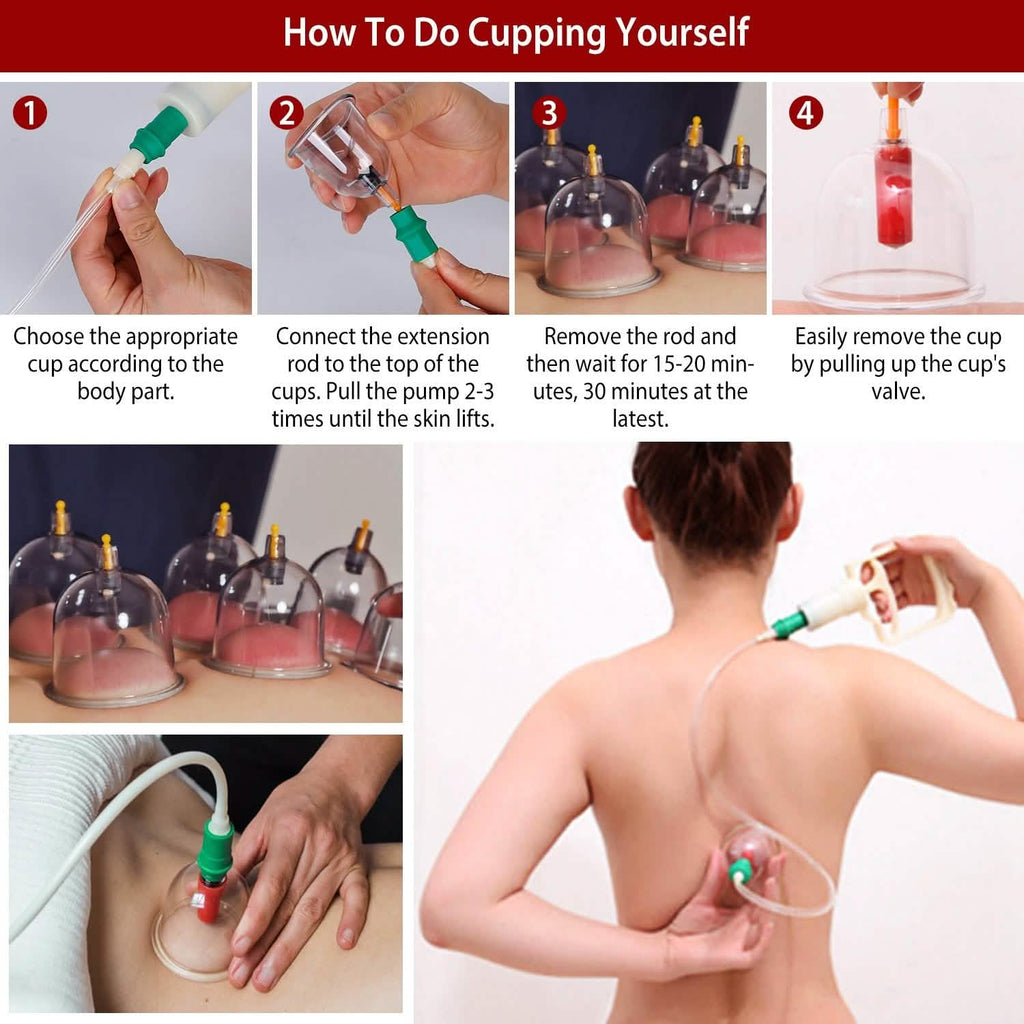 32 Cups Chinese Therapy Set