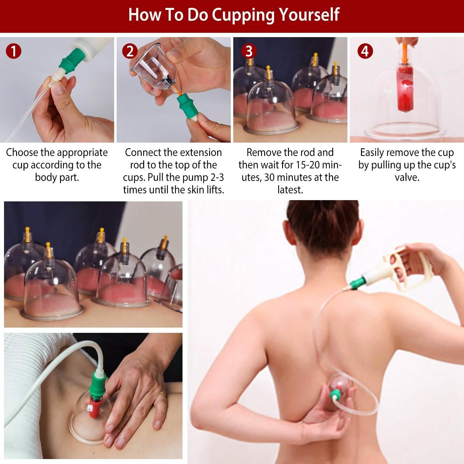 32 Cups Chinese Therapy Set