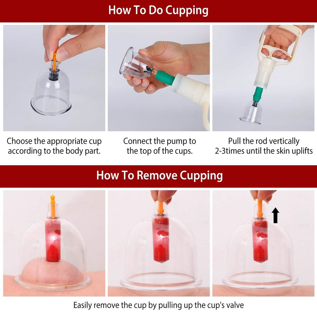 32 Cups Chinese Therapy Set