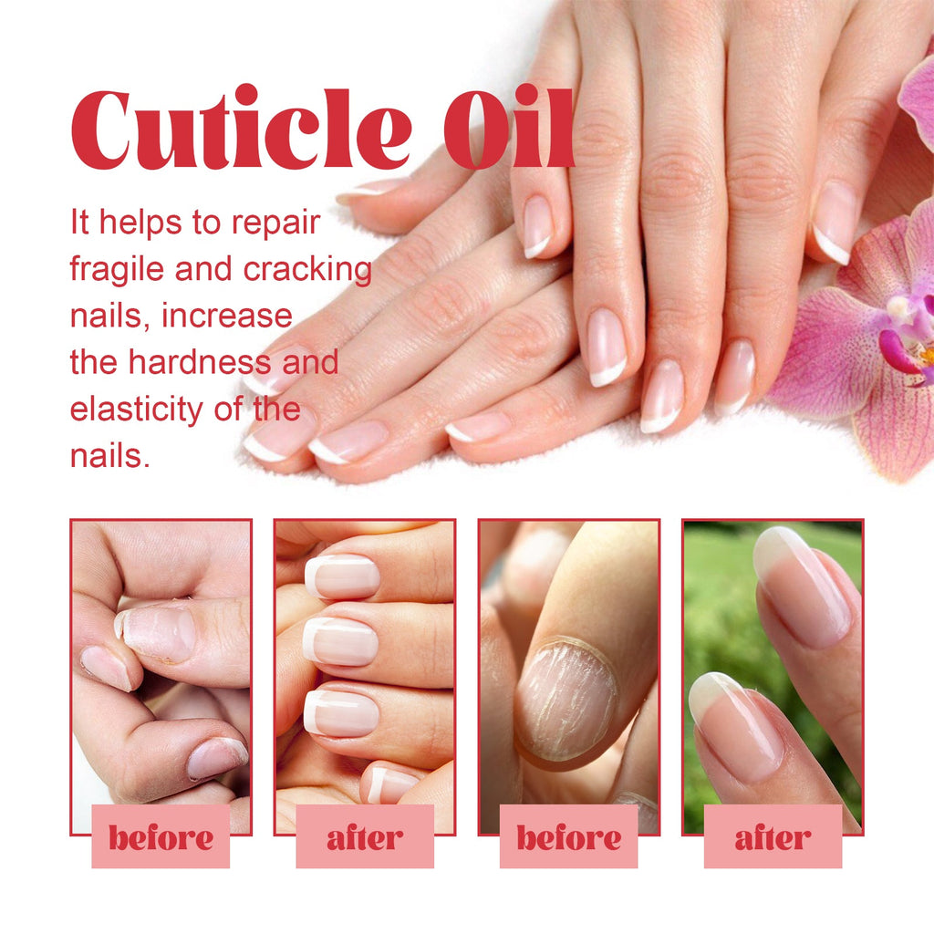 EELHOE Cuticle Oil, Repair The Brotherhood Of Nails Lousy Mail This Light Armour Type Thickening Detailer