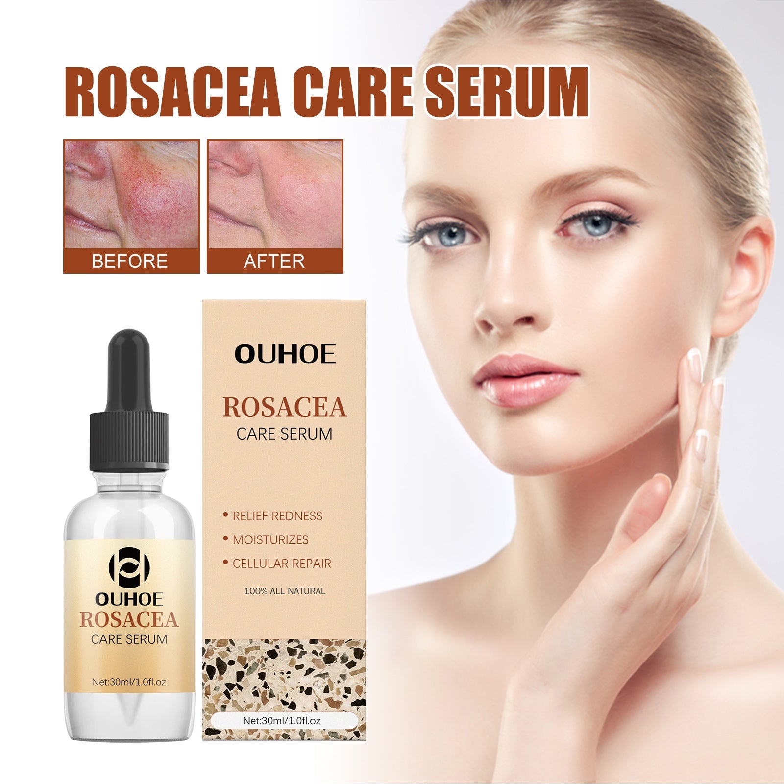 Erythematous Repair Essence, Repair Skin Lighten Facial Erythematous Moisturizing Essential Oil