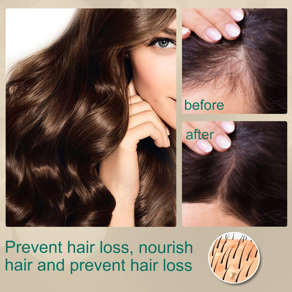 Ginger Hair Care Cream Nourishing, Soft, Nourishing And Repairing Dry Scalp Massage Cream