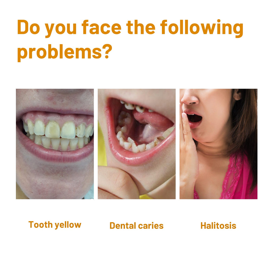 Tooth Whitening Mousse, Clean Teeth Whitening Teeth Care Gums Fresh Oral Care