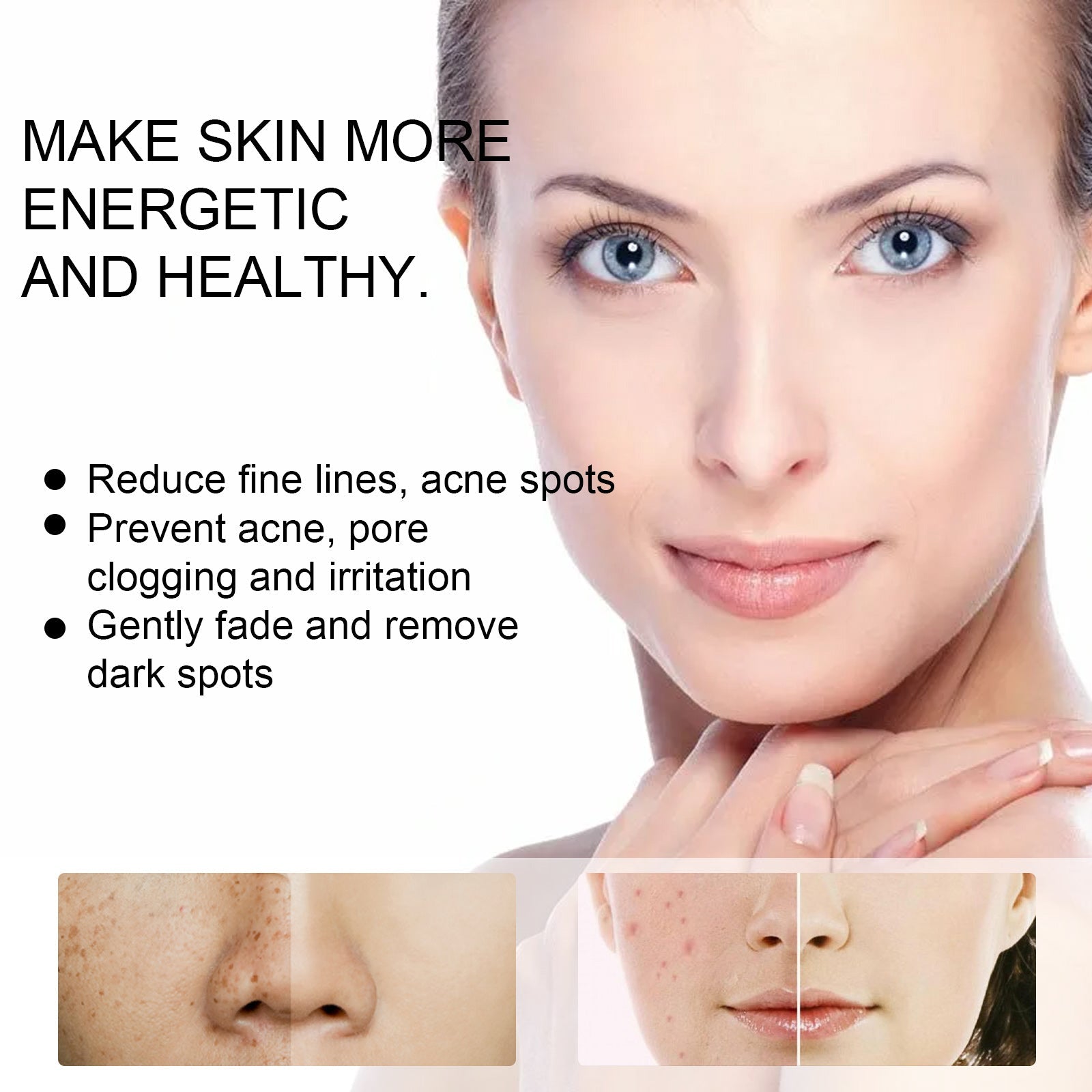 EELHOE Skin Care Cream Improves Dull Skin, Moisturizes Skin, Brightened Skin Care Cream And Clears Acne