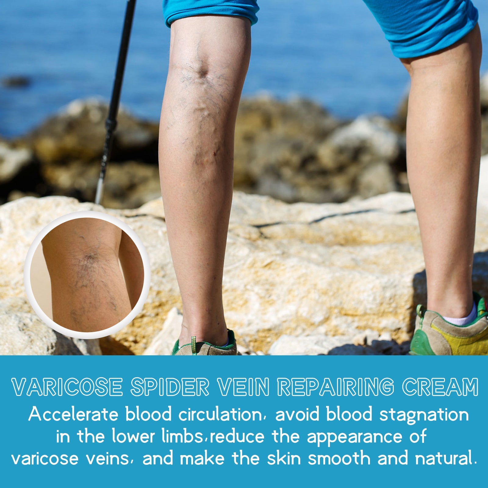 Varicose Spider Vein Repairing Cream, Relief Leg Pain Earthworm Leg Veins Care Massage Cream