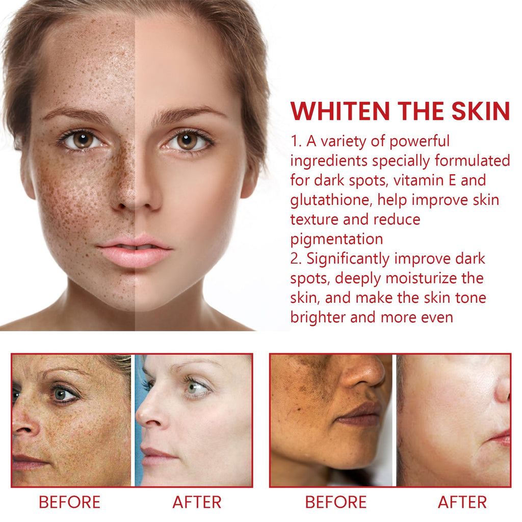 Dark Spot Repair Cream, Restores Dull Skin, Lightening Fine Lines And Dark Spots, Brightening Skin Repair Cream