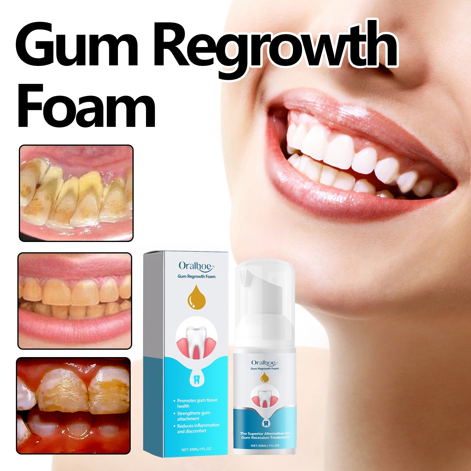 oralhoe Gum Regrowth Foam, Clean Teeth Tartar Care Gums Clean Teeth Anti-Moth Fresh Breath Mousse