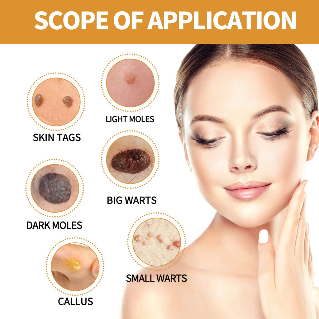 EELHOE Anti-Wart Serum, Deep Cleansing Smooth Skin Fade Hand, Foot And Corns Wart Wart Serum