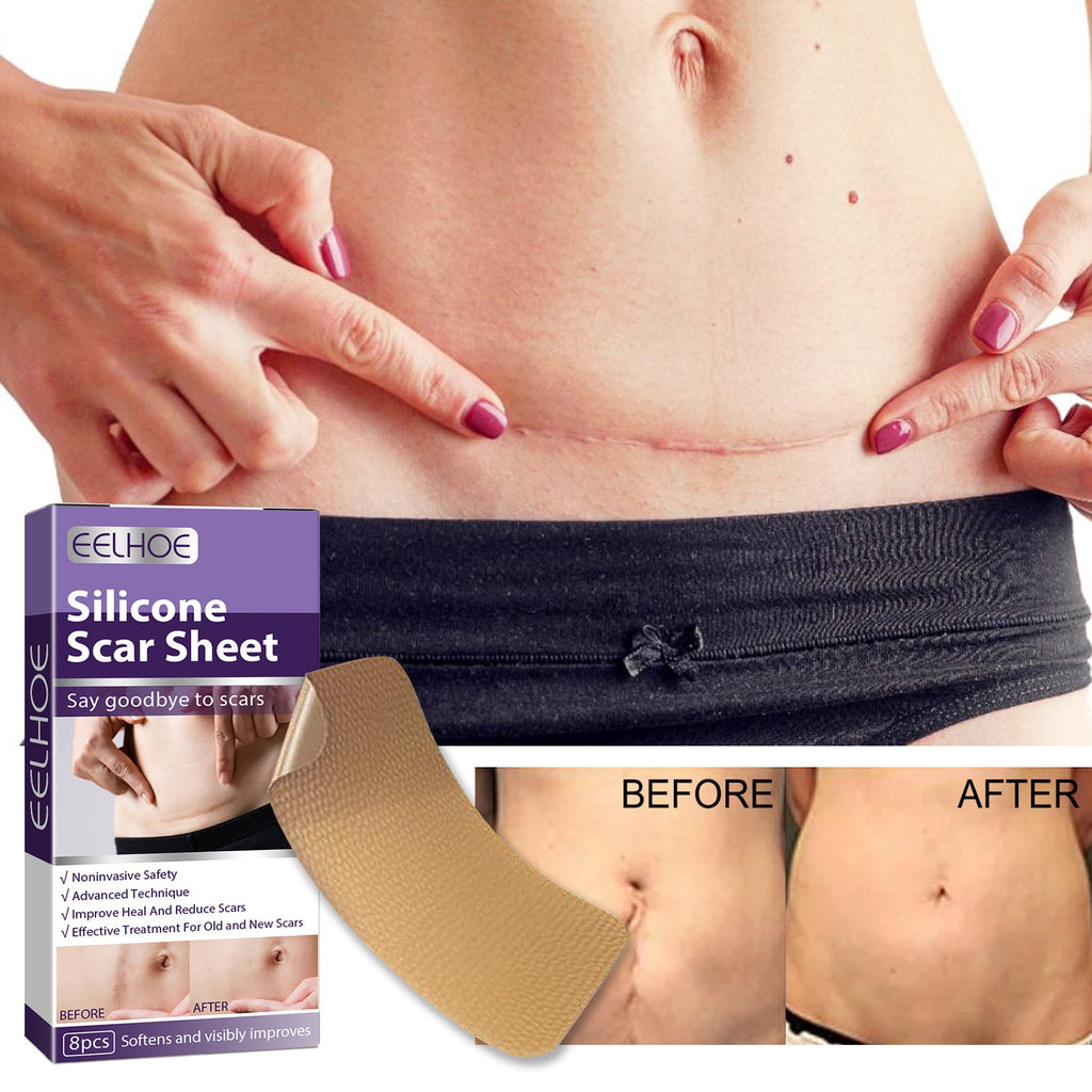 Silicone Scar Patch, Reduces Stretch Marks And Hyperplasia Of Caesarean Section Scars Silicone Patch