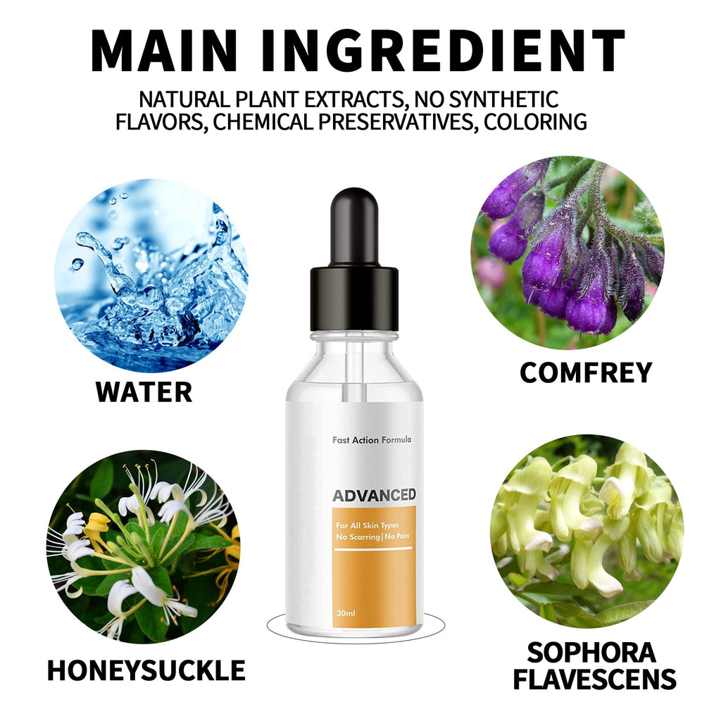 EELHOE Anti-Wart Serum, Deep Cleansing Smooth Skin Fade Hand, Foot And Corns Wart Wart Serum