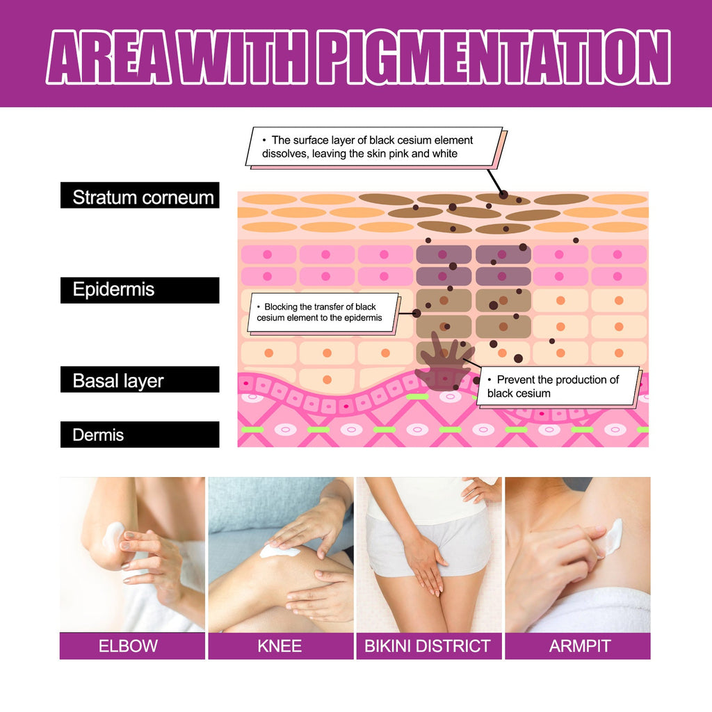 Skin Firming Cream, Brightening Skin Melanin Removal Brightening Skin Moisturizing Cream
