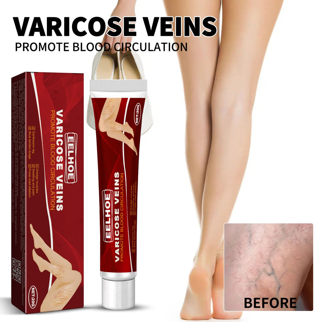 Venous Massage Varicose Cream, Relieves Bulging Leg Blood Vessels And Swollen Leg Earthworm Venous Massage Cream