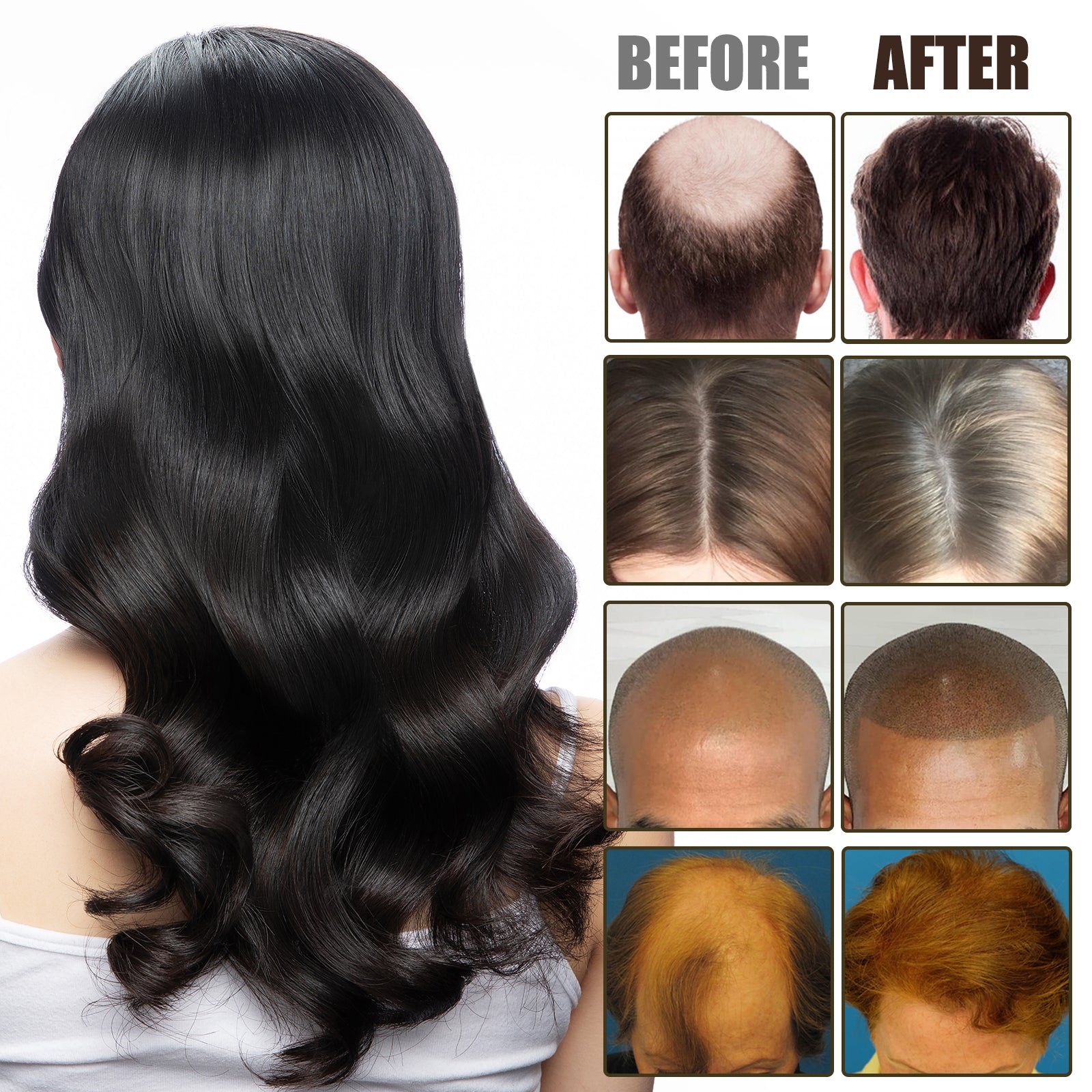 NMN Scalp Cell Revitalizing Hair Essence, Hair Care Strengthen And Strengthen Hair Repair Hair Root Thickening Hair Moisturizing Essence