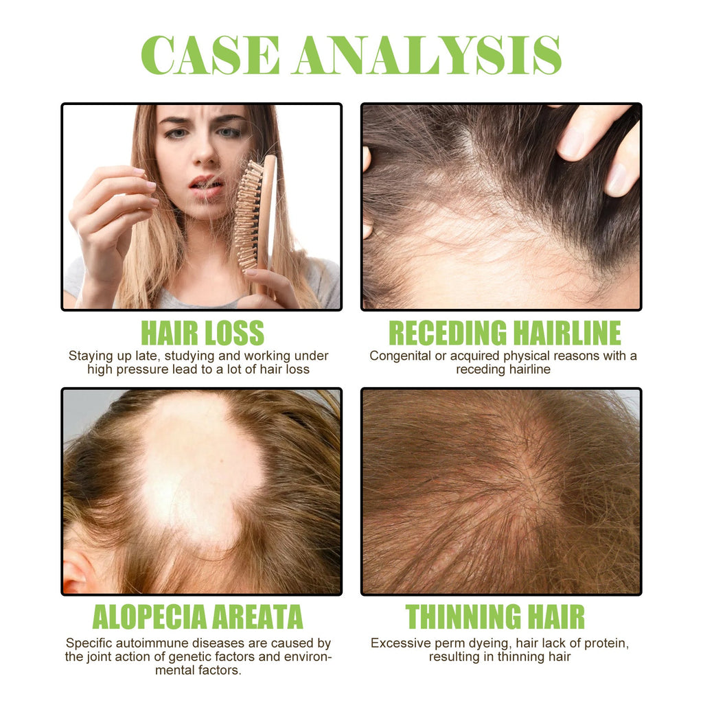 Ginger Care Shampoo Scalp Cleansing, Anti-Break Nourishing Root Strengthening Shampoo