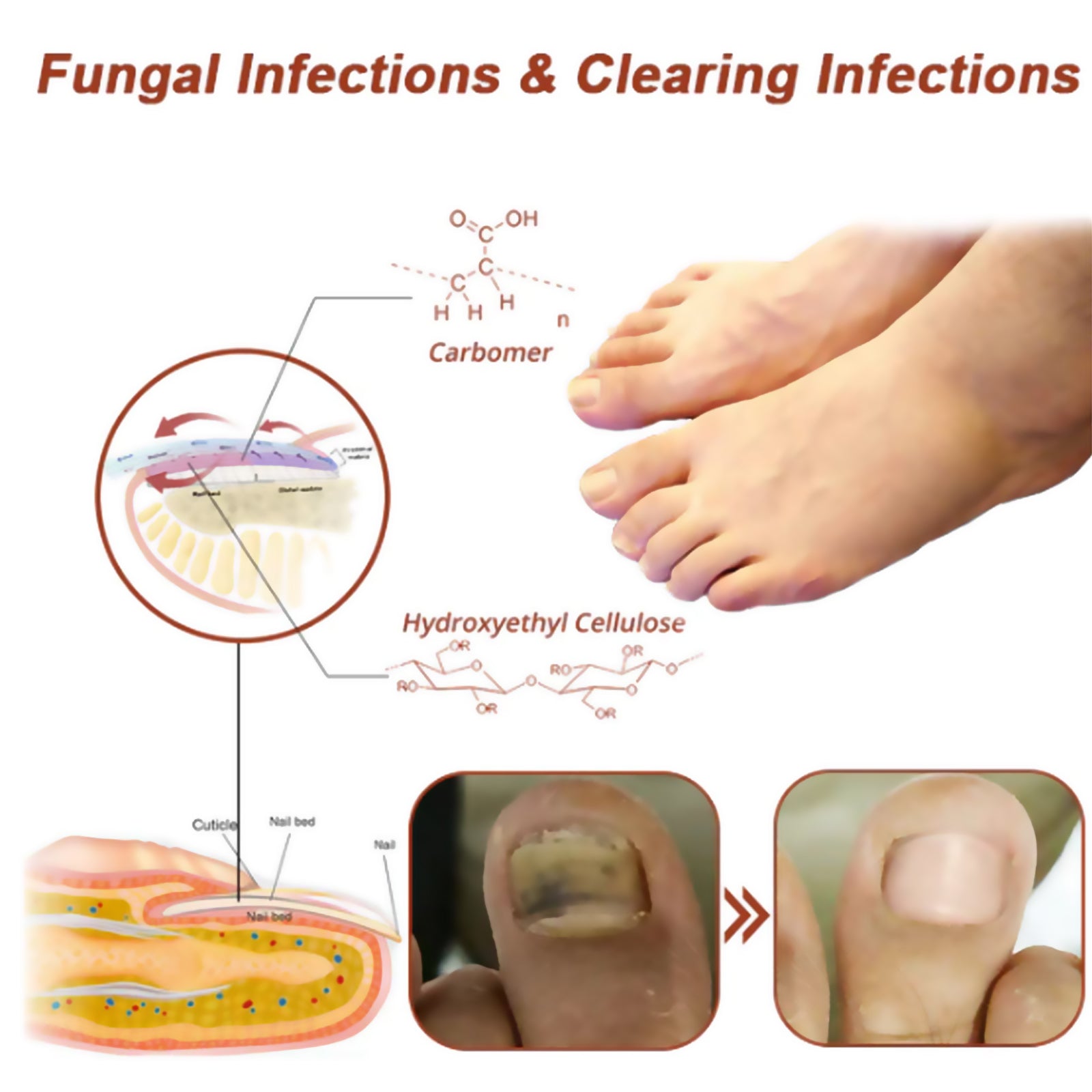 South Moon Nail Care Phototherapy Device, Repair Hands And Feet Gray Nails Yellow Ingrown Nail Soft Nail Care