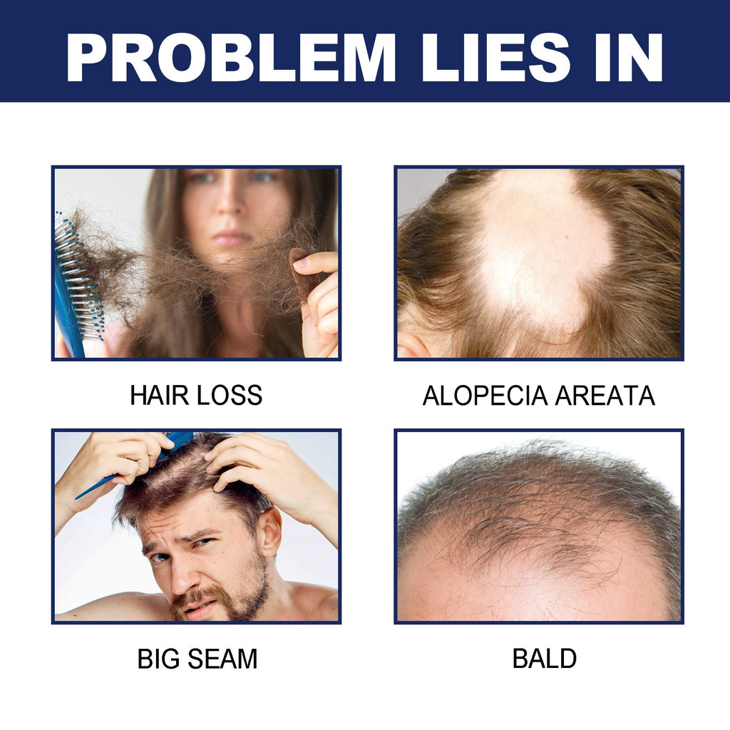 Herbal Hair Care Essential Oil Hair Care Strengthen Hair, Prevent Hair Loss, Repair Hair Root Care Essential Oil
