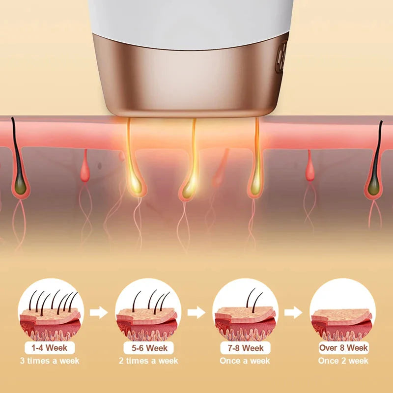 IPL Laser Epilator – Painless Hair Removal Device