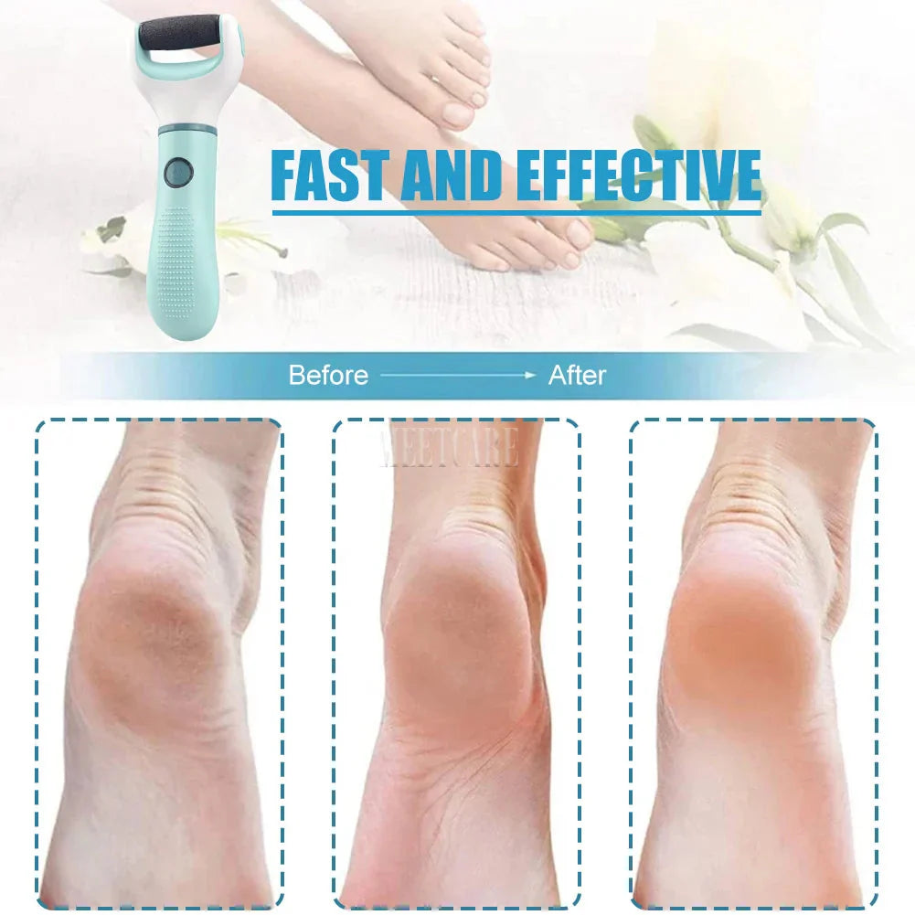 Electric Foot Grinder Dead Skin Remover Callus Pedicure Shaver