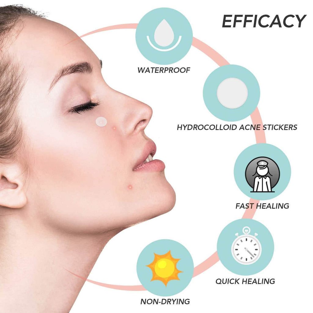 Blemish and Acne Treatment Skin Healing Spot Patches