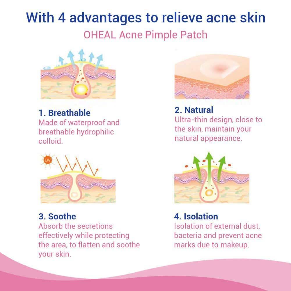 Blemish and Acne Treatment Skin Healing Spot Patches