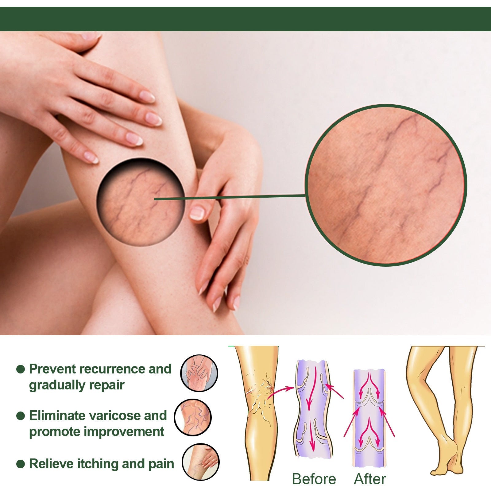 Vein Soap Relief Repair Leg Cleaning Care