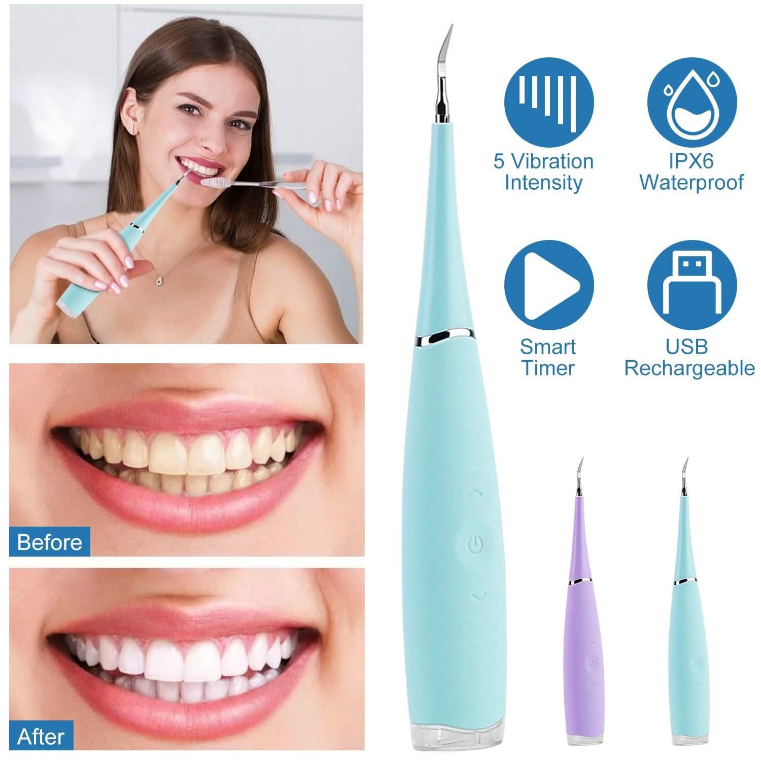 Electric Tartar Remover For Teeth