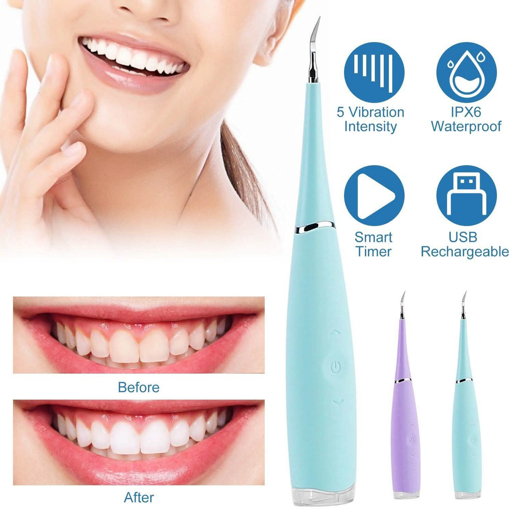 Electric Tartar Remover For Teeth