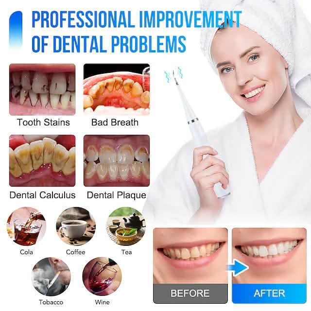 Electric Toothbrush Sonic Dental Scaler Teeth Whitening Kit