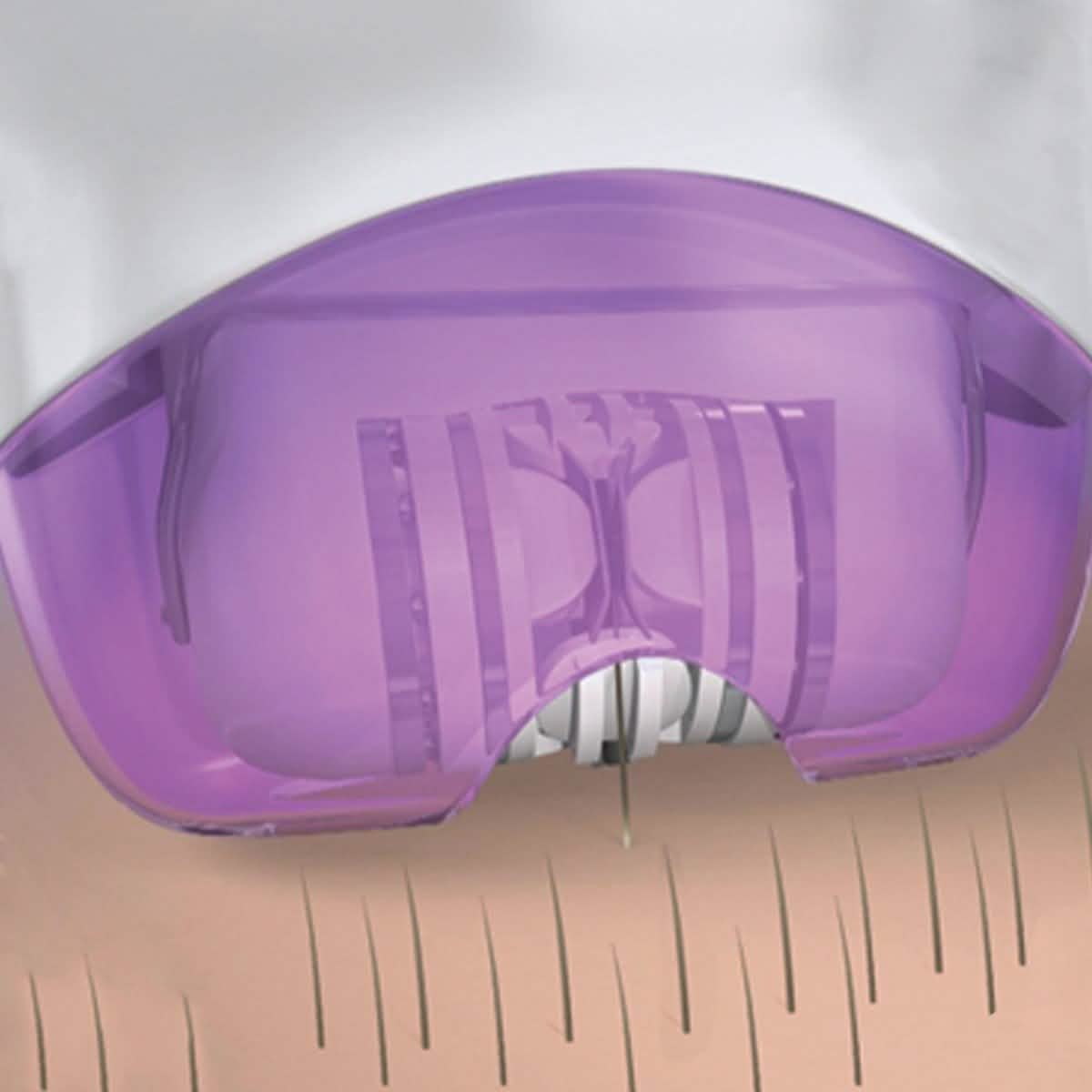 Epi Smooth Removes Hair At The Root