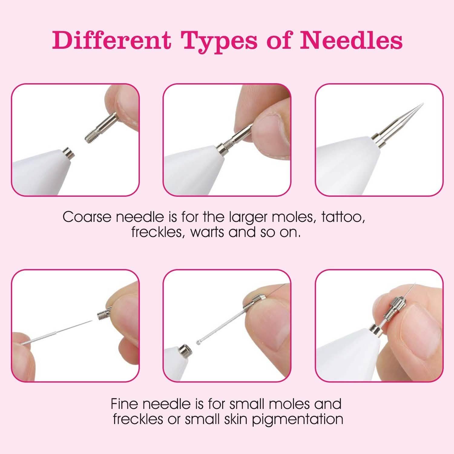 Portable Skin Tag Repair Kit with 6 Replaceable Needles