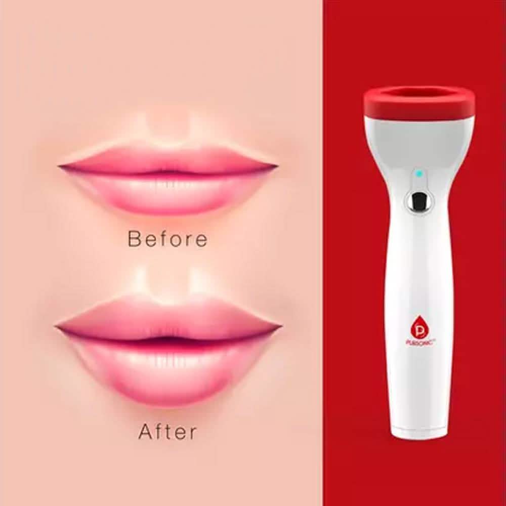 Pursonic Premium Automatic Fuller Lip Plumper