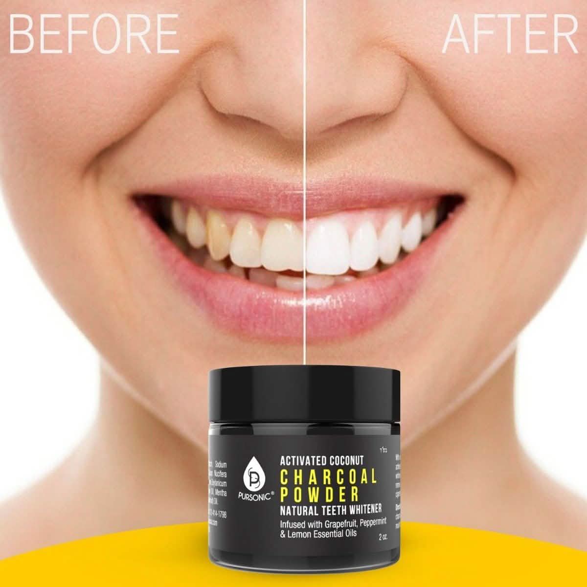 S520 Sonic Toothbrush - Accessories and Activated Coconut Charcoal Powder